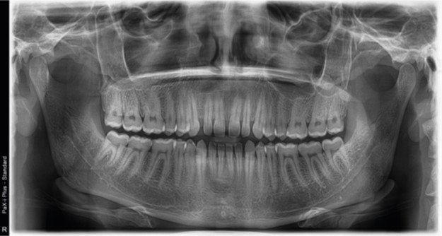 pax-i-plus-x-ray